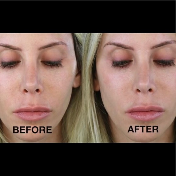 Blur Restorative Microneedle Treatment LAST CALL - Picture 7 of 7